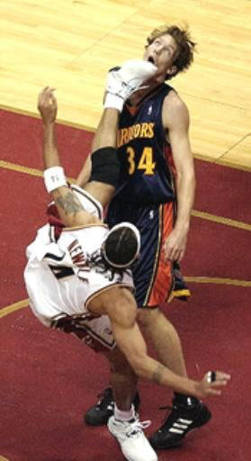 Dunleavy Kicked In Face